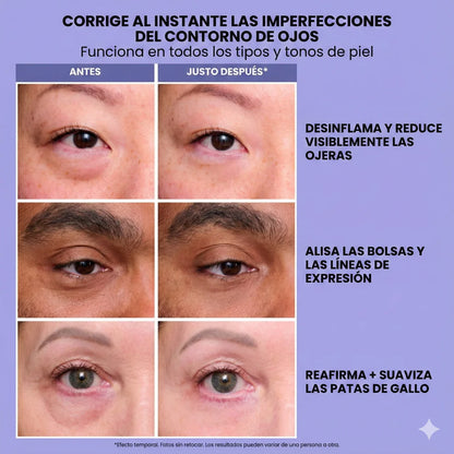 InfiniteLift  - Gel tensor rejuvenecedor de ojos